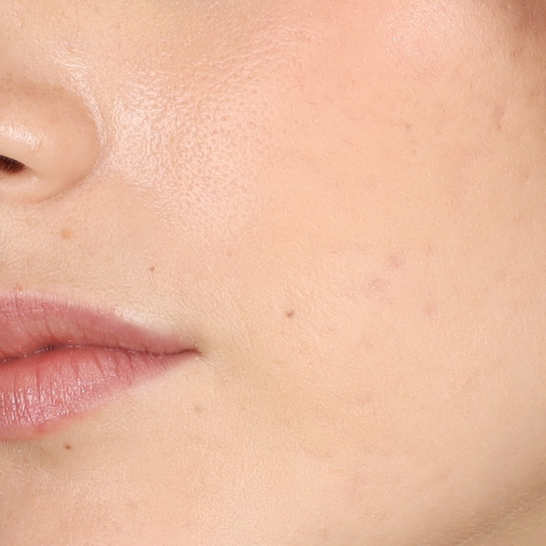 What is the Best Product for Minimizing Pores?